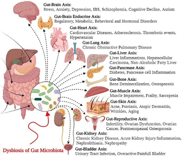 תזונה מטבולית־שיקומית ליתר־פעילות של בלוטת התריס ומחלת גרייבס